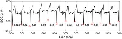 A Persistent Homology Approach to Heart Rate Variability Analysis With an Application to Sleep-Wake Classification